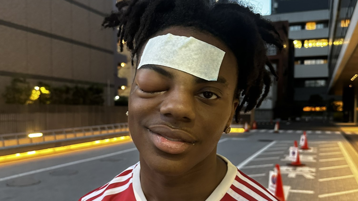 iShowSpeed with a swollen eye and a bandage on his forehead in Tokyo.