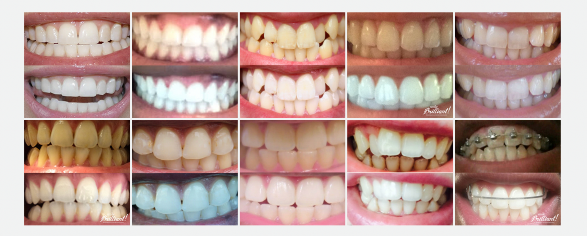 White teeth cheat code: Using this revolutionary dental system will ...