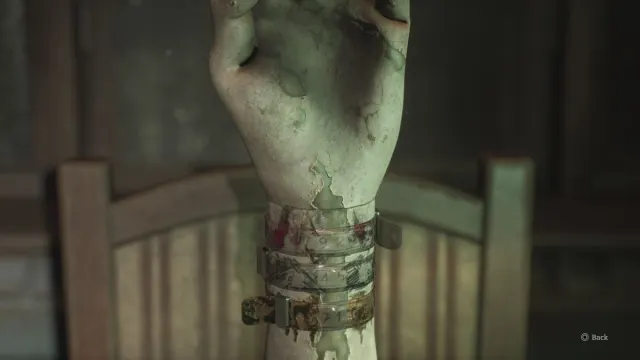 A close up of the Director's Office hand with the patient bracelets on it